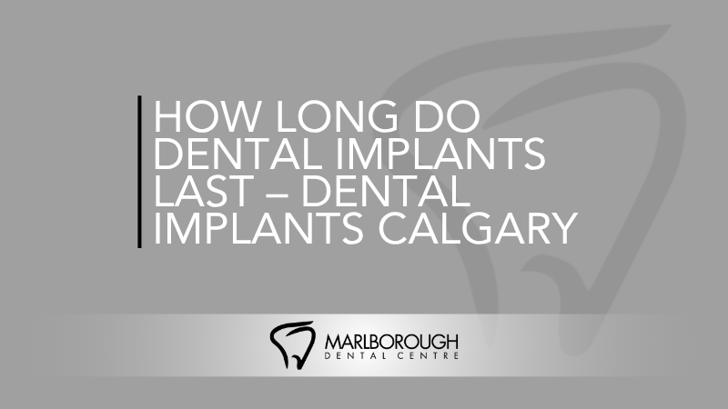How Long Do Dental Implants Last – Dental Implants Calgary